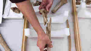 Civil War Battlefield 'Limb Pit' Reveals Work Of Combat Surgeons 