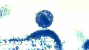 Discovery of HIV variant shows virus can evolve to be more severe — and contagious