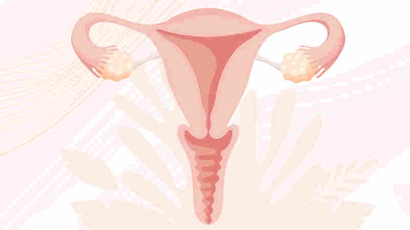 Up to 80 percent of women will have a uterine fibroid by age 50